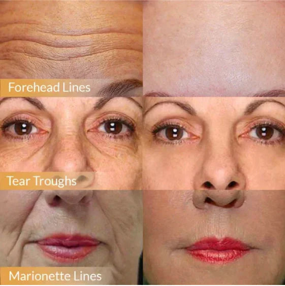 1+1 Gratis | Polypeptid Straffende Gesichtscreme | Mit Schwarzer Orchidee, Granatapfel & Ginseng | Tiefenpflege & Strahlende Haut