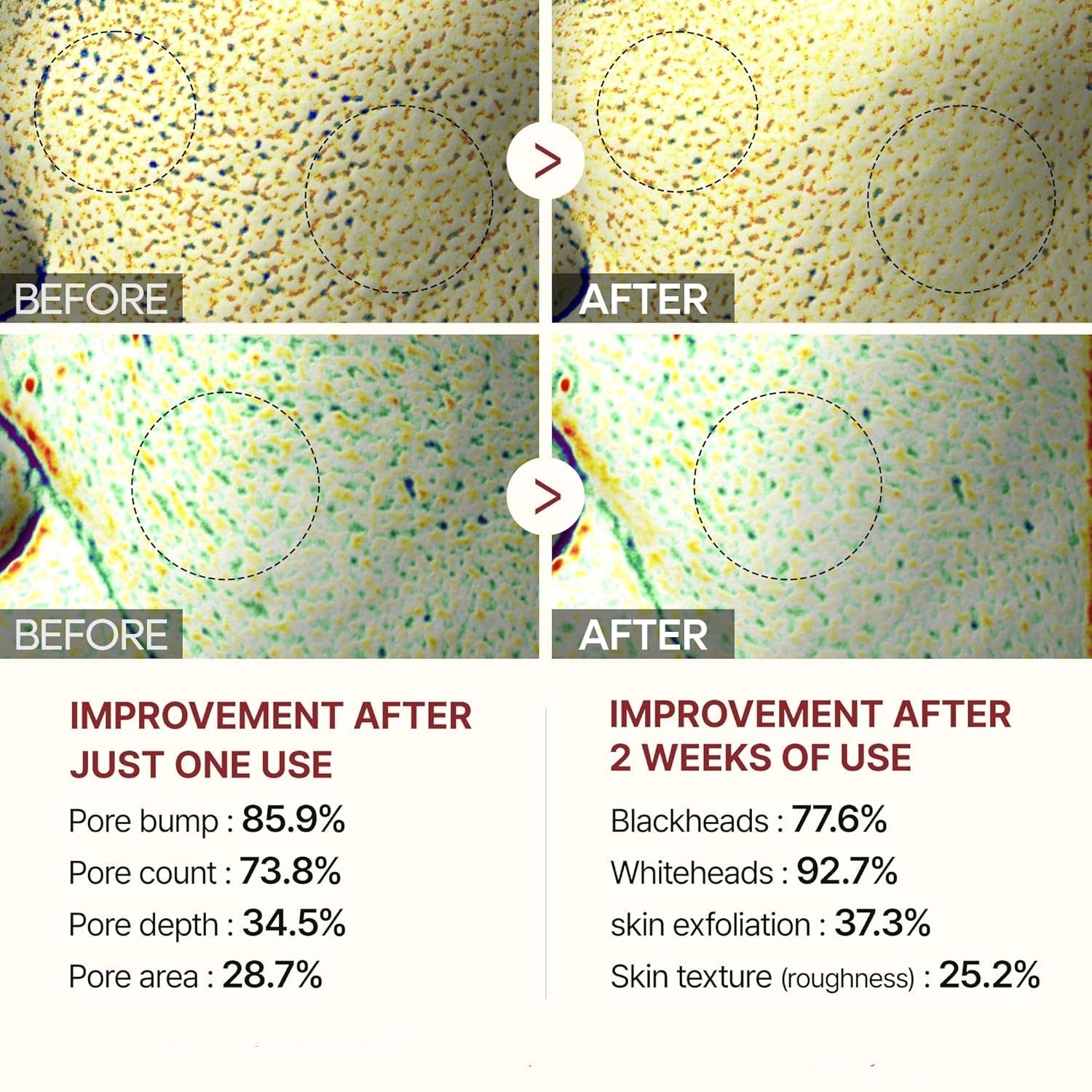 Gesichtspeeling mit Reisextrakt | Sanfte Reinigung ohne Reizungen | Entfernt Ablagerungen sofort