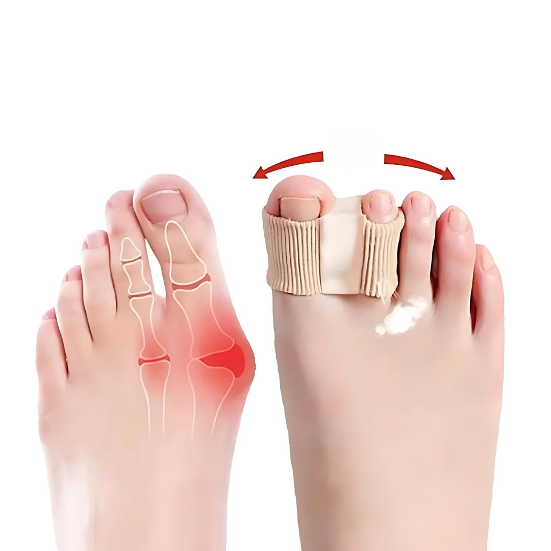 Premium Zehentrenner | Elastische Separatoren für Ballenzehen & Fehlstellungen | Nylon & SEBS