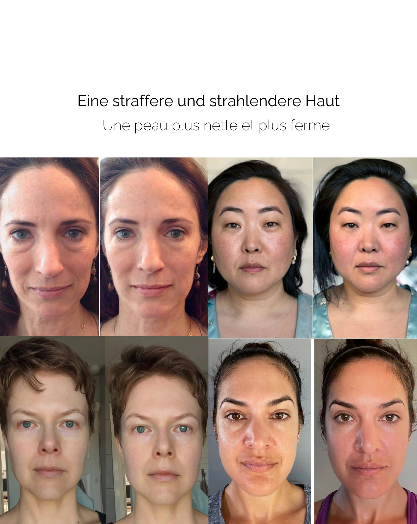 GlühenGlide™ Aktivator für jugendliches Strahlen