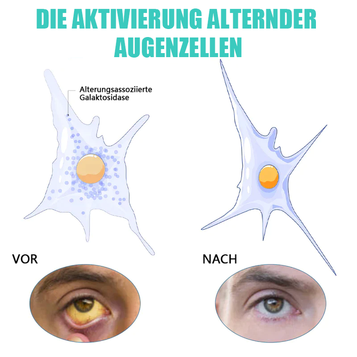 AugenLinderung™ Hydratisieren Sie müde Augen
