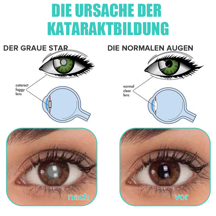 AugenLinderung™ Hydratisieren Sie müde Augen