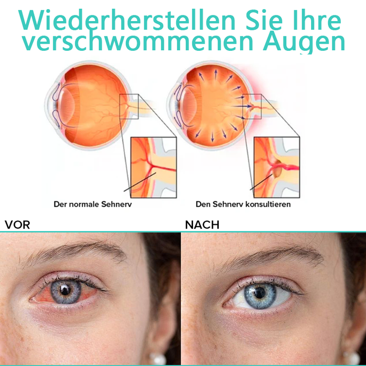 AugenLinderung™ Hydratisieren Sie müde Augen