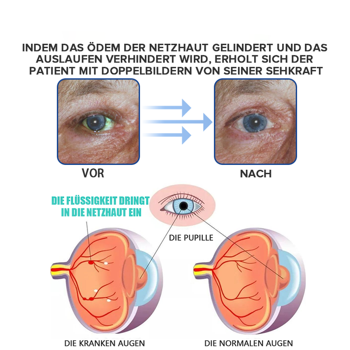 AugenLinderung™ Hydratisieren Sie müde Augen