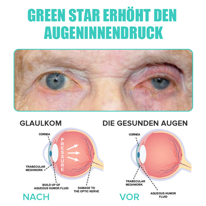 AugenLinderung™ Hydratisieren Sie müde Augen