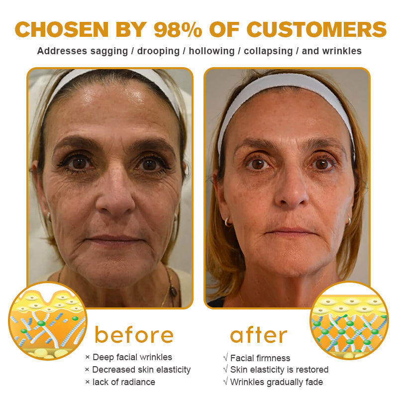 2+2 Gratis | Anti-Falten Creme | Straffende Gesichtscreme mit Feuchtigkeit & Glow Effekt | Glättet Falten & Verleiht Jugendliche Haut