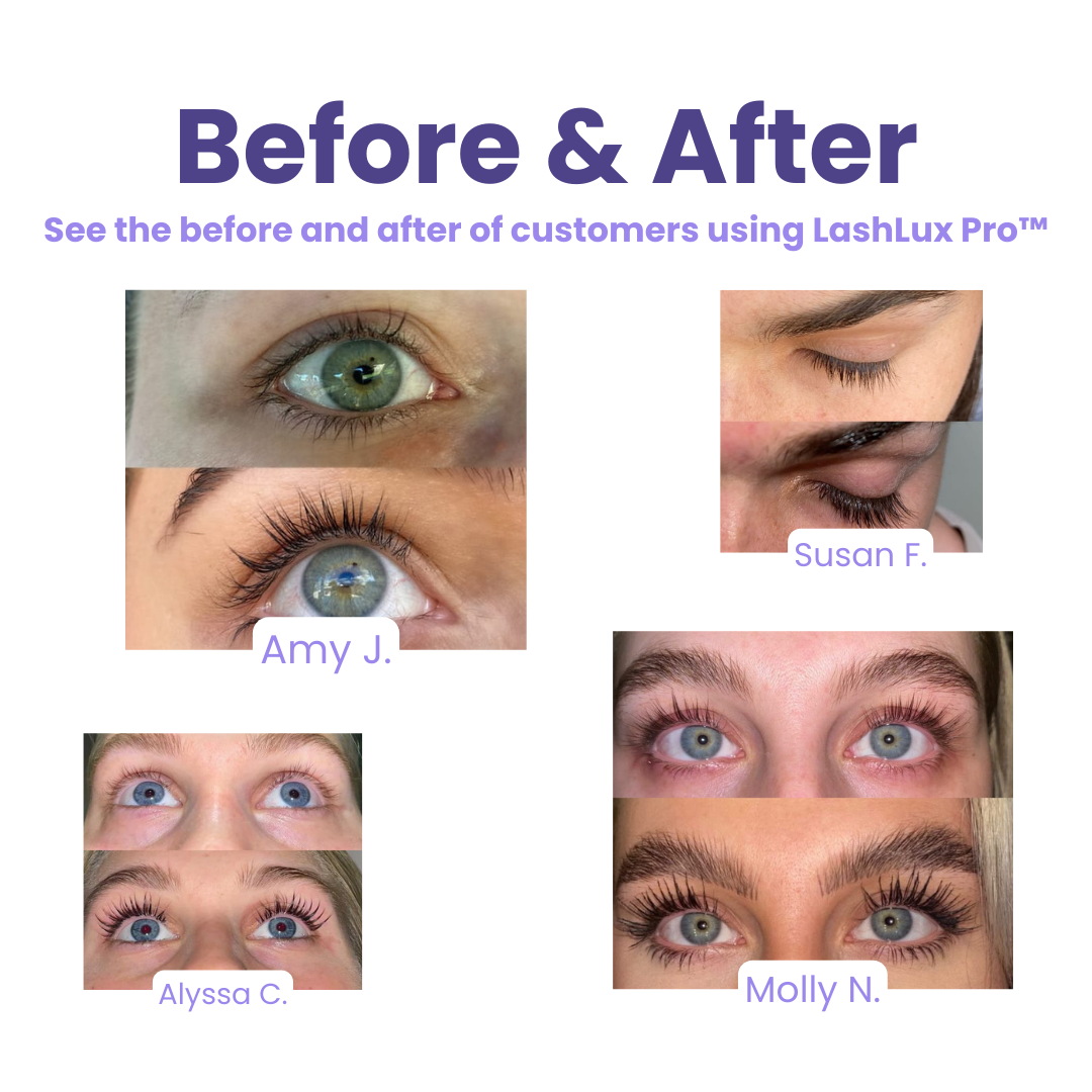 1+1 Gratis | Wimpernserum | Natürliches Wimpernwachstum & Pflege | Dermatologisch Getestet